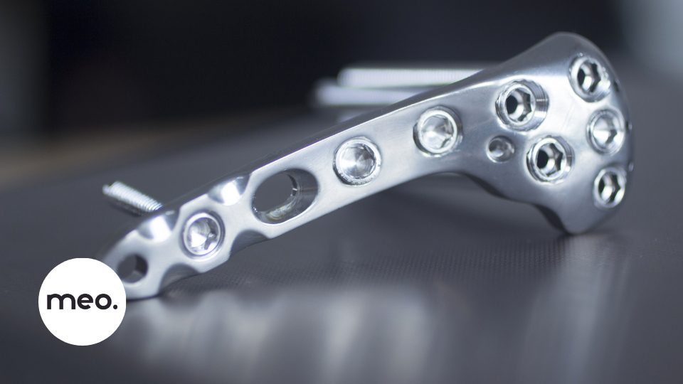 powder screening medical implants